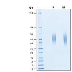 R&D Systems&trade;&nbsp;Recombinant Human B7-H6 His-tag Avi-tag Protein