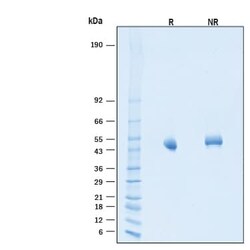 R D Systems Recombinant Human SIRP gamma/CD172g His Avi-tag Protein, CF 50 &mu;g | Buy Online | R&amp;D Systems&trade; | Fisher Scientific