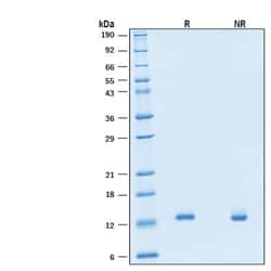 R D Systems Recombinant Human IL-2 (CD122-Directed) Protein, CF 1 mg | Buy Online | R&amp;D Systems&trade; | Fisher Scientific