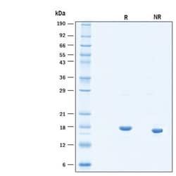 R D Systems Recombinant Human IL-7 Protein 25 &mu;g | Buy Online | R&amp;D Systems&trade; | Fisher Scientific