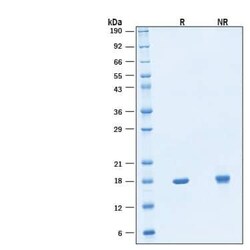 R D Systems Recombinant Human IL-18/IL-1F4 GMP Protein, CF 50 &mu;g | Buy Online | R&amp;D Systems&trade; | Fisher Scientific