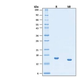 R D Systems Recombinant Human IL-21 Protein, Animal-Free 1 mg | Buy Online | R&amp;D Systems&trade; | Fisher Scientific