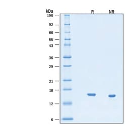 R D Systems Recombinant Human IL-21 Protein, CF 100 &mu;g | Buy Online | R&amp;D Systems&trade; | Fisher Scientific