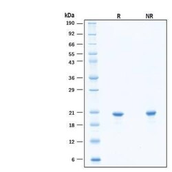 R D Systems Recombinant Human FGF-10 Heat Stable Protein, CF 500 &mu;g | Buy Online | R&amp;D Systems&trade; | Fisher Scientific
