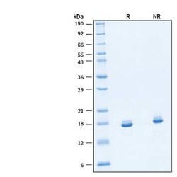 R D Systems Recombinant Human FGF basic Heat Stable Protein, Animal-Free 25 &mu;g | Buy Online | R&amp;D Systems&trade; | Fisher Scientific