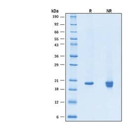 R D Systems Recombinant Human KGF/FGF-7 Protein, Animal-Free 50 &mu;g | Buy Online | R&amp;D Systems&trade; | Fisher Scientific