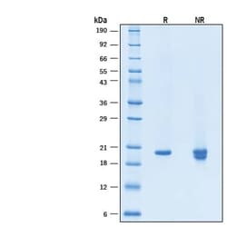 R D Systems Recombinant Human KGF/FGF-7 GMP Protein, CF 50 &mu;g | Buy Online | R&amp;D Systems&trade; | Fisher Scientific