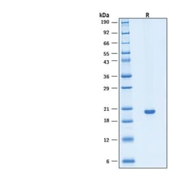 R D Systems Recombinant Human KGF/FGF-7 Protein, CF 50 &mu;g | Buy Online | R&amp;D Systems&trade; | Fisher Scientific