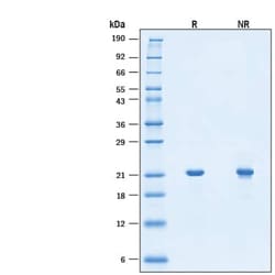 R D Systems Recombinant Mouse Sonic Hedgehog/Shh GMP Protein, CF 500 &mu;g | Buy Online | R&amp;D Systems&trade; | Fisher Scientific