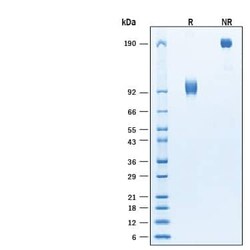 R D Systems Recombinant Human 5T4 Fc Chimera Biotinylated Protein, CF 100 &mu;g | Buy Online | R&amp;D Systems&trade; | Fisher Scientific