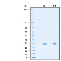 R D Systems Recombinant Human IL-6 (HEK293-expressed) Biotin Protein 50 &mu;g | Buy Online | R&amp;D Systems&trade; | Fisher Scientific