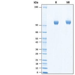 R&D Systems™ Recombinant Human ACE-2 His-tag Biotinylated Protein