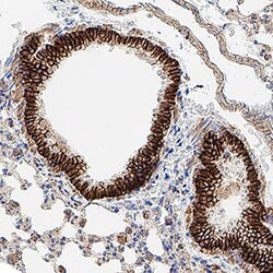 Mouse EpCAM/TROP-1 Antibody, R D Systems:Antibodies:Primary Antibodies