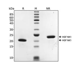 R D Systems Recombinant Human HGF (NK1), Animal-Free Protein 500 &mu;g | Buy Online | R&amp;D Systems&trade; | Fisher Scientific