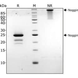 R D Systems Recombinant Mouse/Rat Noggin, Animal-Free Protein 500 &mu;g | Buy Online | R&amp;D Systems&trade; | Fisher Scientific