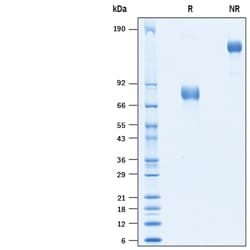 R D Systems Recombinant Human uPAR Fc Chimera Protein 100 &mu;g | Buy Online | R&amp;D Systems&trade; | Fisher Scientific