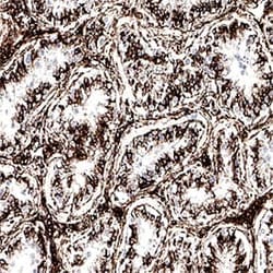 R D Systems Mouse VisUCyte HRP Polymer-DAB Cell Tissue Staining Kit 50 Tests | Buy Online | R&amp;D Systems&trade; | Fisher Scientific