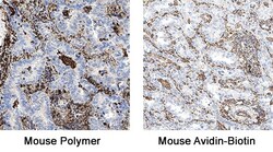 R D Systems Mouse VisUCyte HRP Polymer-DAB Cell Tissue Staining Kit 50 Tests | Buy Online | R&amp;D Systems&trade; | Fisher Scientific