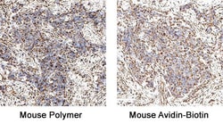R D Systems Mouse VisUCyte HRP Polymer-DAB Cell Tissue Staining Kit 50 Tests | Buy Online | R&amp;D Systems&trade; | Fisher Scientific