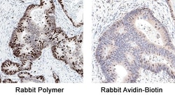 R D Systems Rabbit VisUCyte HRP Polymer-DAB Cell Tissue Staining Kit 50 tests | Buy Online | R&amp;D Systems&trade; | Fisher Scientific