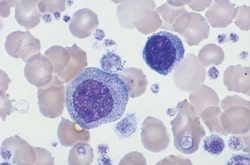 Sigma-Aldrich Wright Stain, Modified
