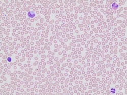Sigma-Aldrich Automated Wright Stain Set