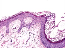 Sigma-Aldrich&nbsp;Hematoxylin Solution, Gill No. 1