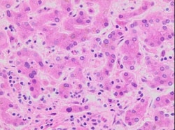 Sigma-Aldrich Hematoxylin Solution, Gill No. 3