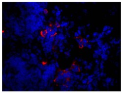 IgM Goat anti-Mouse, Human ads, TRITC (Rhodamine), Polyclonal, Southern Biotech 1.0 mg | Buy Online | Southern Biotechnology Associates | Fisher Scientific