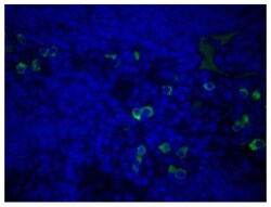 IgM Goat F(ab')2 anti-Mouse, Human ads, AF 488, Polyclonal, Southern Biotech 0.5 mg | Buy Online | Southern Biotechnology Associates | Fisher Scientific