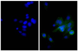 IgG Goat anti-Mouse, Human ads, Biotin, Polyclonal, Southern Biotech 1.0 mg | Buy Online | Southern Biotechnology Associates | Fisher Scientific
