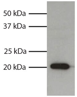 IgG1 Goat anti-Mouse, Human ads, HRP, Polyclonal, Southern Biotech 1.0 mL | Buy Online | Southern Biotechnology Associates | Fisher Scientific
