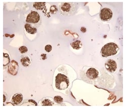 Southern Biotechnology Associates&nbsp;IgG1 Goat anti-Mouse, Human ads, HRP, Polyclonal, Southern Biotech&trade;