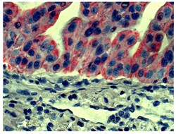 IgG2a Goat anti-Mouse, Human ads, AP, Polyclonal, Southern Biotech 1.0 mL | Buy Online | Southern Biotechnology Associates | Fisher Scientific