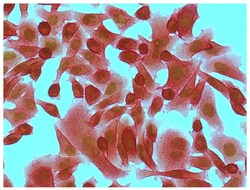 IgG2a Goat anti-Mouse, Human ads, AP, Polyclonal, Southern Biotech 1.0 mL | Buy Online | Southern Biotechnology Associates | Fisher Scientific