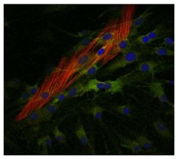 IgG2a Goat anti-Mouse, Human ads, Texas Red, Polyclonal, Southern Biotech 1.0 mg | Buy Online | Southern Biotechnology Associates | Fisher Scientific