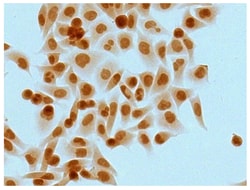 IgG2b Goat anti-Mouse, Human ads, HRP, Polyclonal, Southern Biotech Horseradish