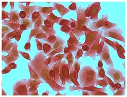 IgG2b Goat anti-Mouse, Human ads, HRP, Polyclonal, Southern Biotech Horseradish