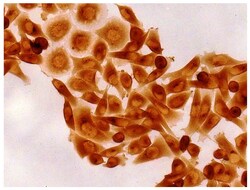 IgG2b Goat anti-Mouse, Human ads, HRP, Polyclonal, Southern Biotech Horseradish