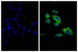 Southern Biotechnology Associates&nbsp;IgG2b Goat F(ab')2 anti-Mouse, Human ads, FITC, Polyclonal, Southern Biotech&trade;