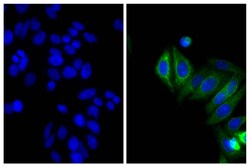 Southern Biotechnology Associates&nbsp;IgG2b Goat anti-Mouse, Human/Bovine/Horse SP ads, Biotin, Polyclonal, Southern Biotech&trade;