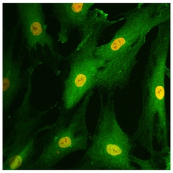 Southern Biotechnology Associates&nbsp;Goat Anti-Rabbit IgG (H+L Chain Specific) Secondary Antibodies, SouthernBiotech&trade;