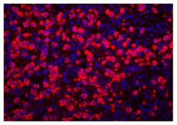 Goat Anti-Rabbit IgG (H+L Chain Specific) Secondary Antibodies, SouthernBiotech 1.0 mg | Buy Online | Southern Biotechnology Associates | Fisher Scientific