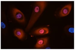 Southern Biotechnology Associates&nbsp;Goat Anti-Rabbit IgG (H+L Chain Specific) Secondary Antibodies, SouthernBiotech&trade;