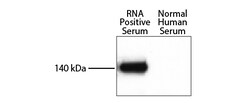 Southern Biotechnology Associates&nbsp;IgG(H+L) Goat F(ab')2 anti-Rabbit, Human ads, HRP, Polyclonal, Southern Biotech&trade;