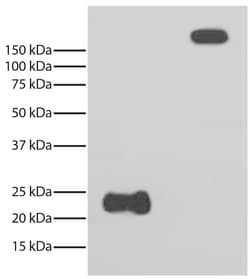 Light Chain Mouse anti-Rabbit, HRP, Clone: SB62a, Southern Biotech 1.0 mL | Buy Online | Southern Biotechnology Associates | Fisher Scientific