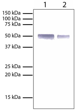 Southern Biotechnology Associates&nbsp;IgG Mouse anti-Rabbit, AP, Clone: 2A9, Southern Biotech&trade;