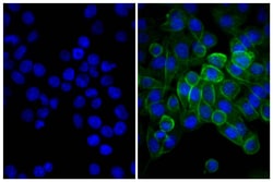 Southern Biotechnology Associates&nbsp;IgG(H+L) Donkey anti-Mouse, Human SP ads, FITC, Polyclonal, Southern Biotech&trade;