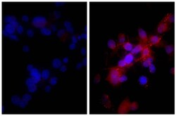 Southern Biotechnology Associates&nbsp;IgG(H+L) Donkey anti-Rabbit, Mouse/Rat/Human SP ads, Biotin, Polyclonal, Southern Biotech&trade;