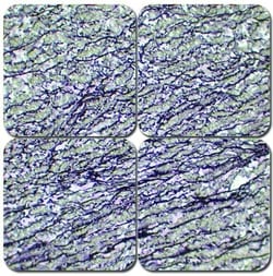 StatLab™ MasterTech Verhoeff's Elastic Stain Kit